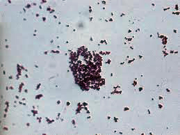 Argent colloïdal Staphyloccus aureus ATCC12600